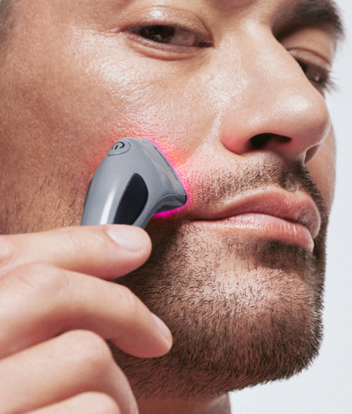 Rotlichttherapie bei Akne
